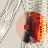 Lendenwirbelsäulenarthrose